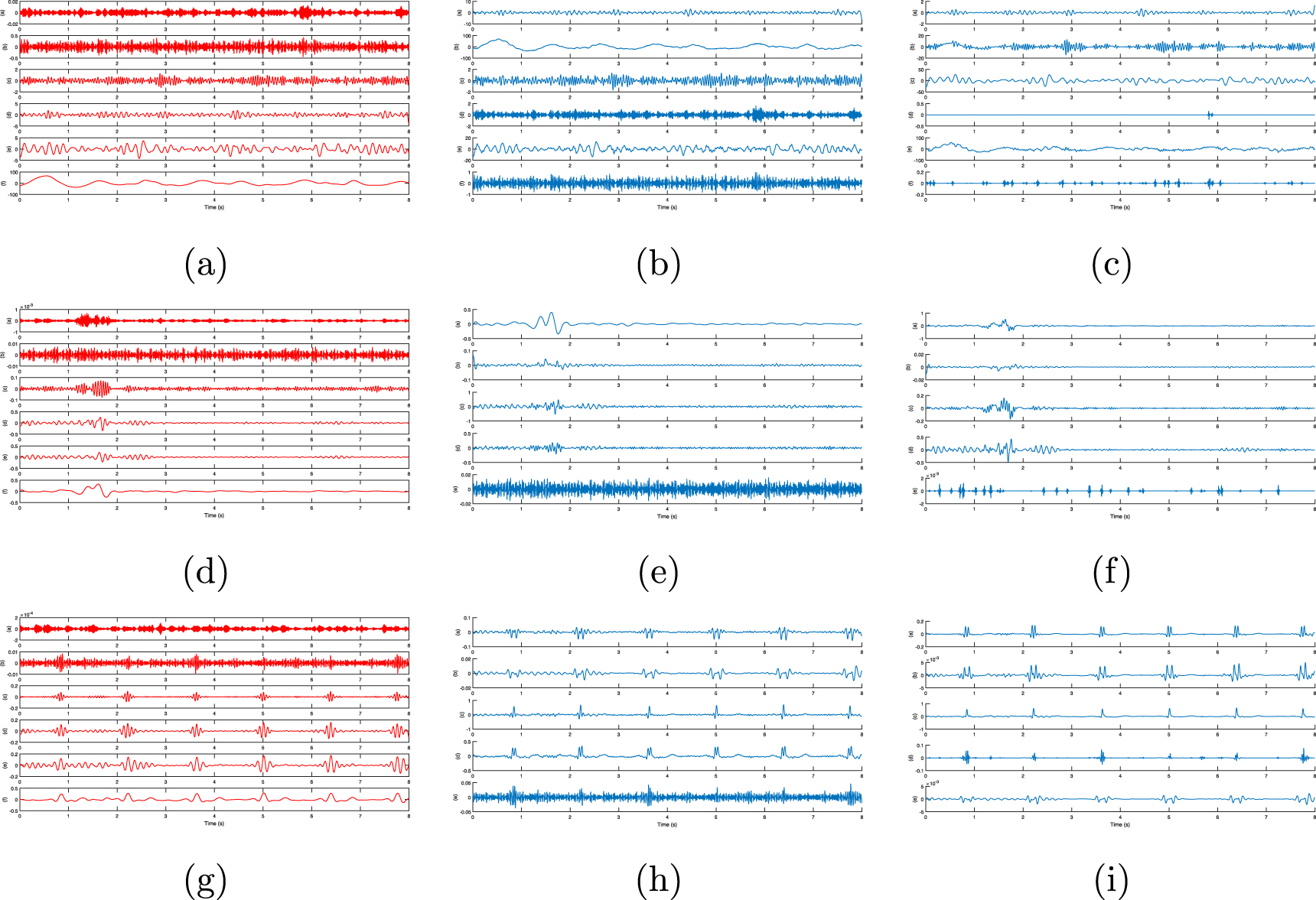 Hybrid algorithm for multi artifact removal from single channel EEG ...