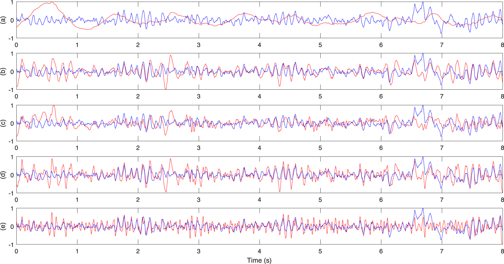 Hybrid algorithm for multi artifact removal from single channel EEG ...
