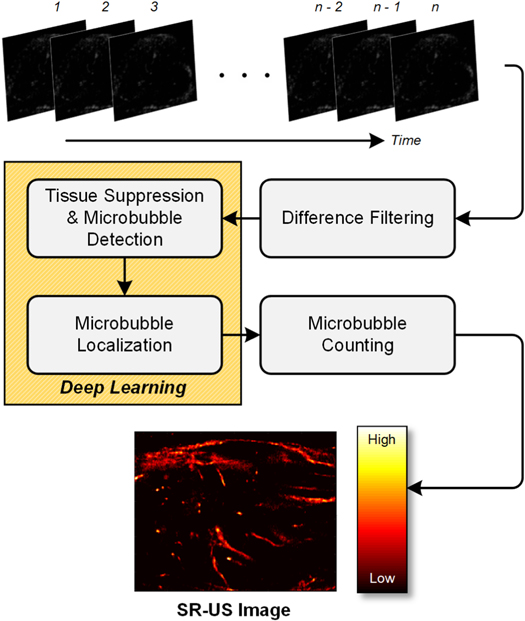 Faster super-resolution ultrasound imaging with a deep learning model ...