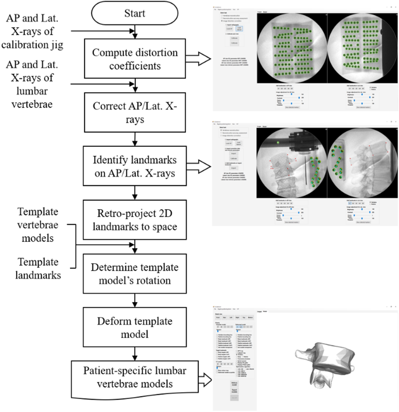 Reconstruction of three-dimensional lumbar vertebrae from biplanar x ...