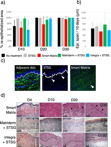 Wound healing properties of a fibrin-based dermal replacement scaffold ...