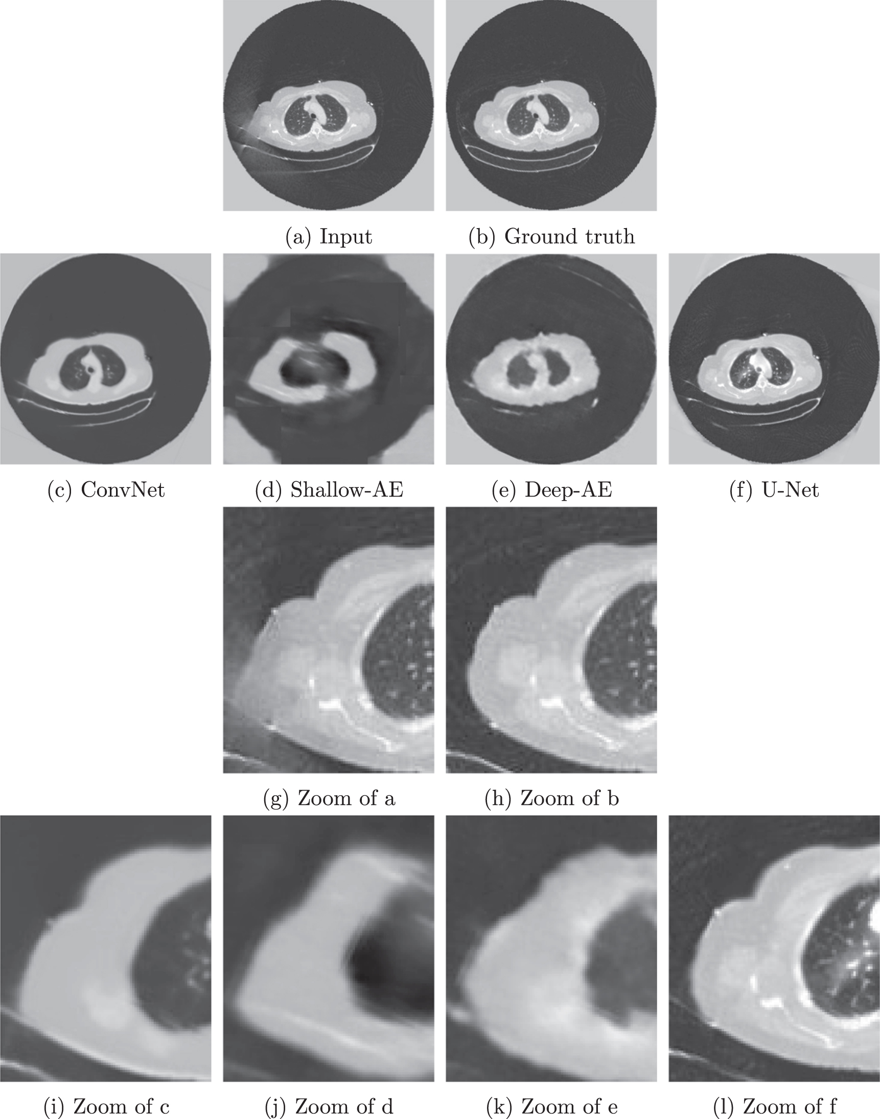 Deep learning-based extended field of view computed tomography image ...