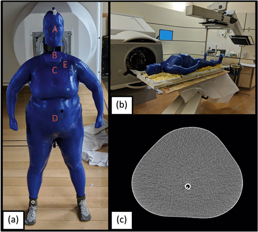 Personalized 3D-printed anthropomorphic whole-body phantom irradiated ...
