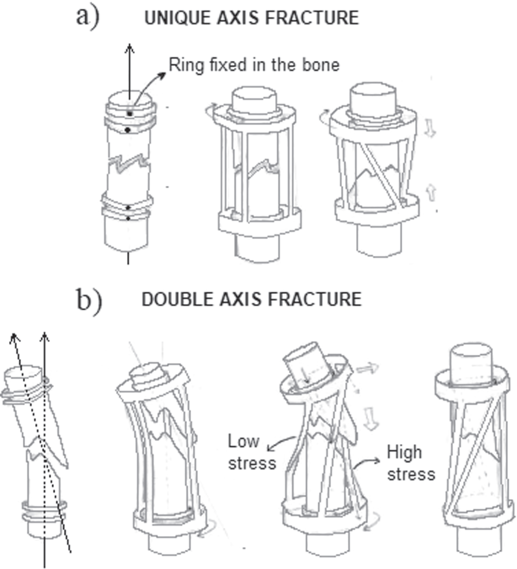 Bioinspired design proposal for a new external bone fixator device ...