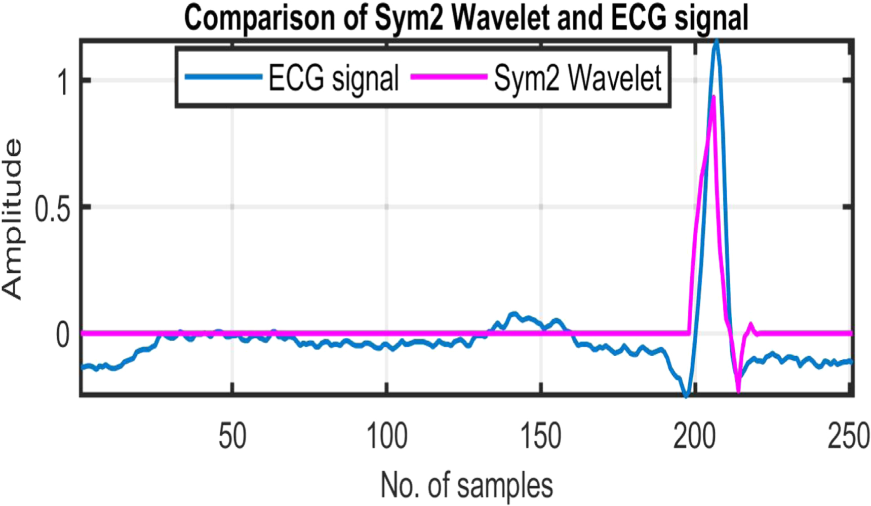 QRS complex detection using stationary wavelet transform and adaptive ...