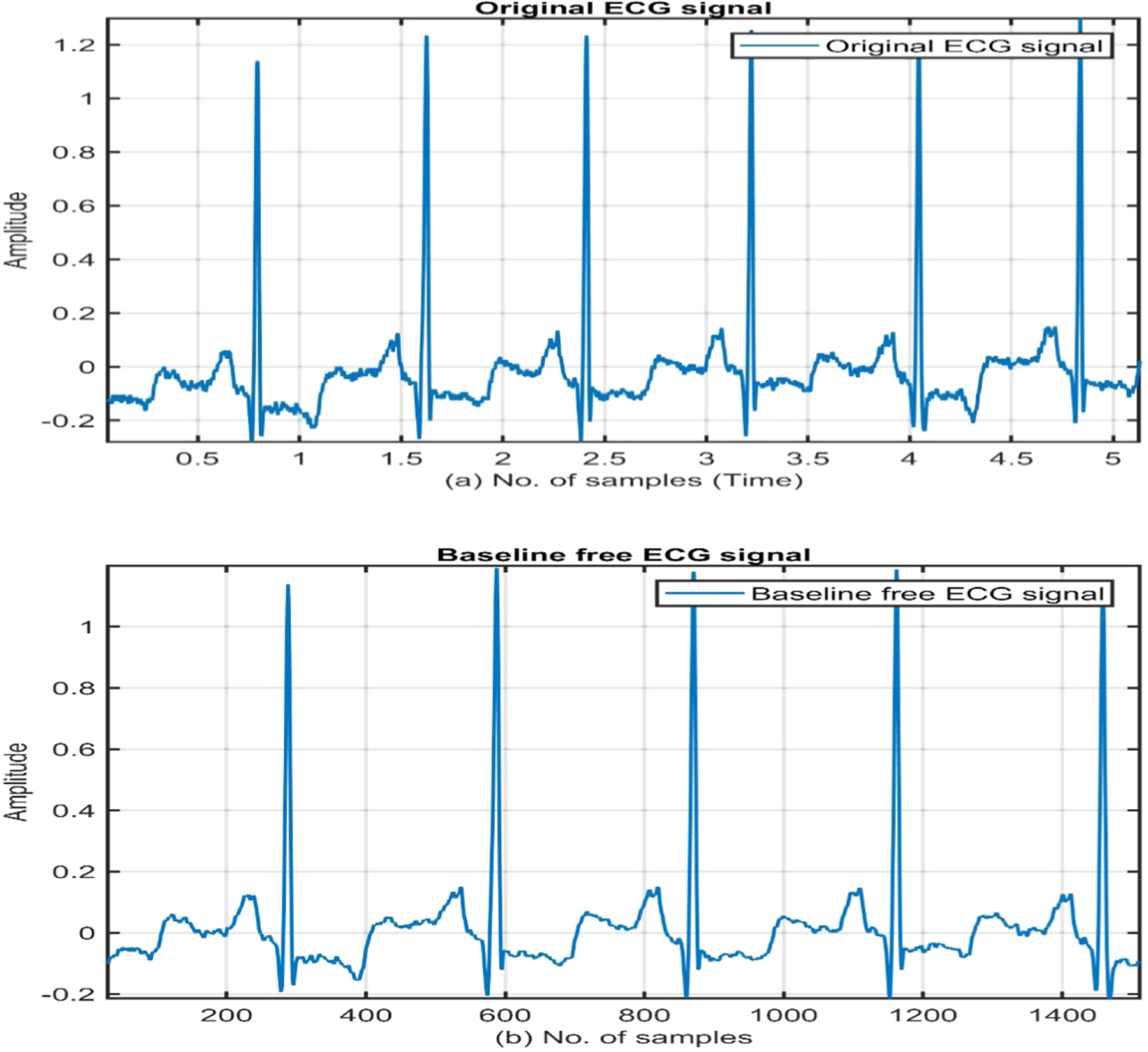 QRS complex detection using stationary wavelet transform and adaptive ...