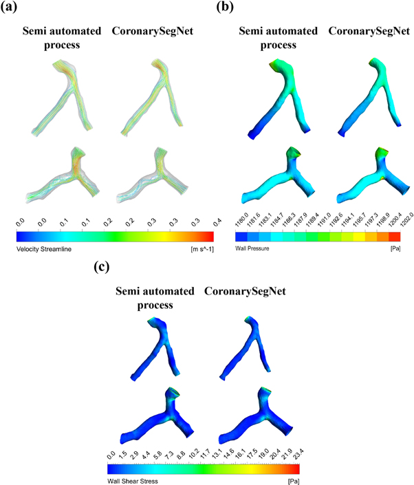 Segmenting 3D geometry of left coronary artery from coronary CT ...