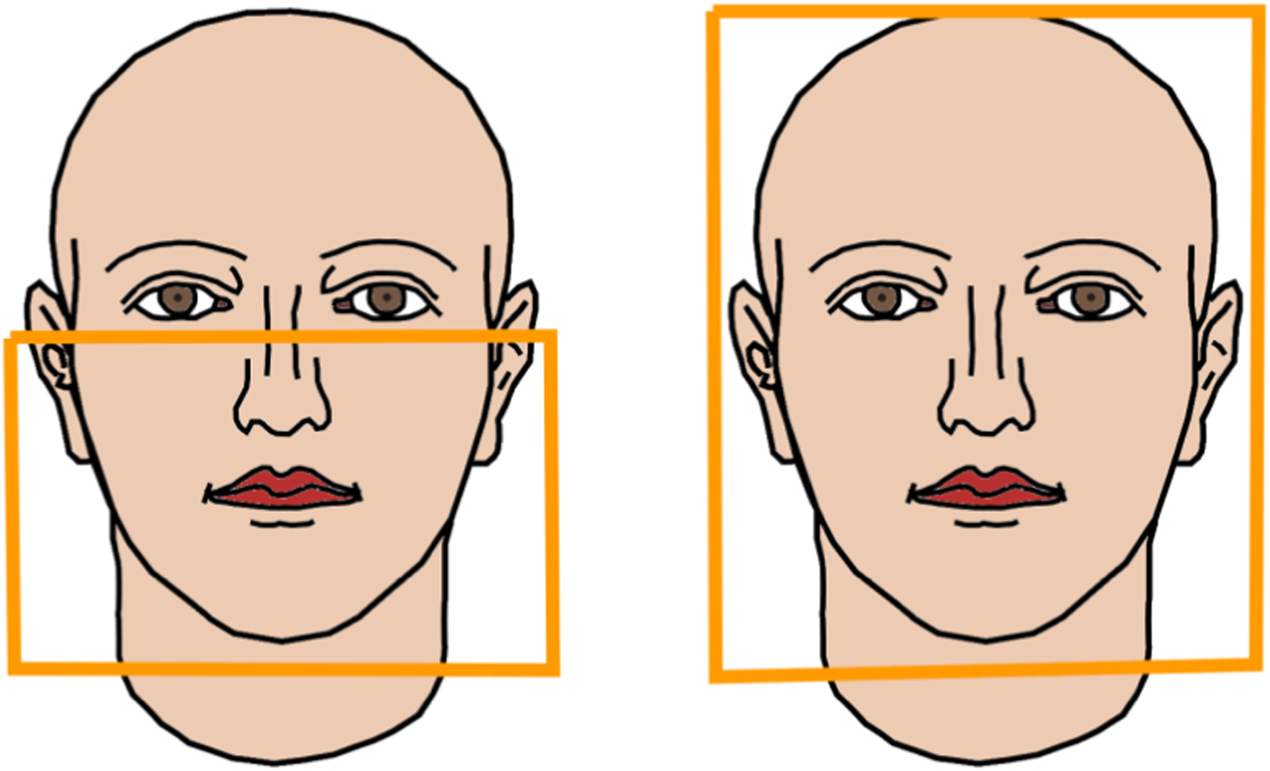 The use of dynamic CT imaging for tracking mandibular movements in a  phantom - IOPscience