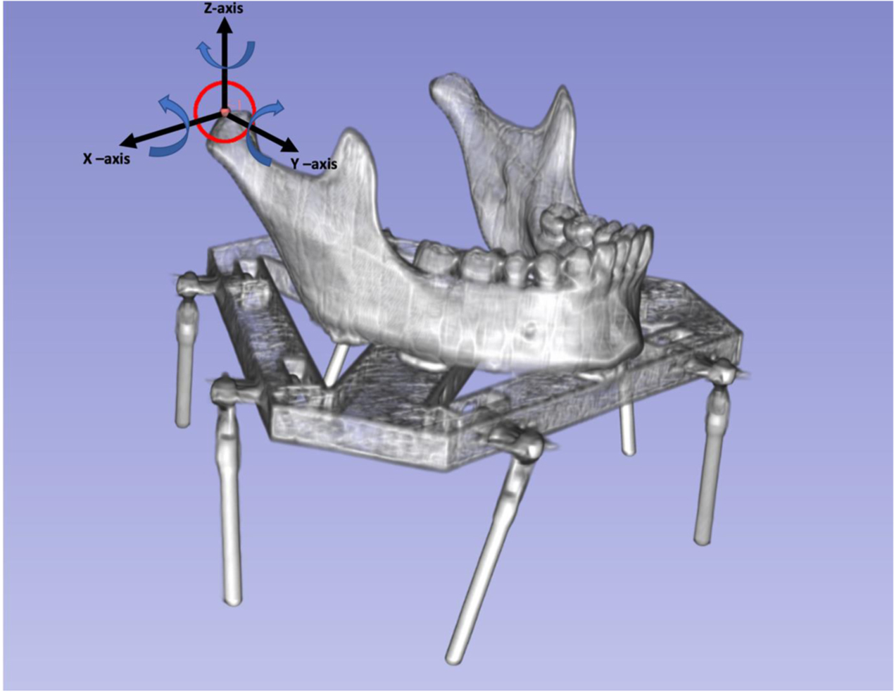 The use of dynamic CT imaging for tracking mandibular movements in a  phantom - IOPscience