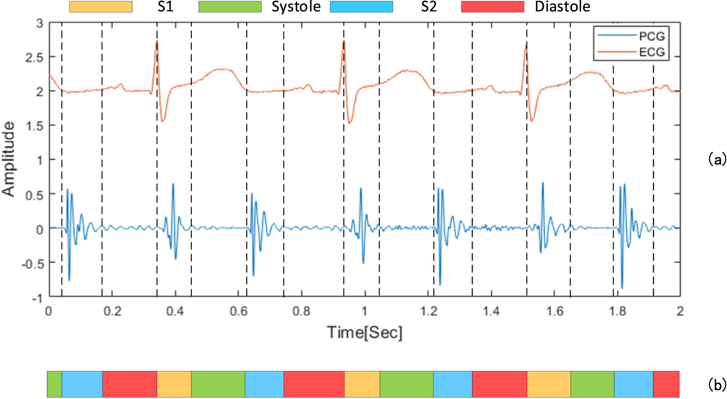 A novel heart sound segmentation algorithm via multi-feature input and ...