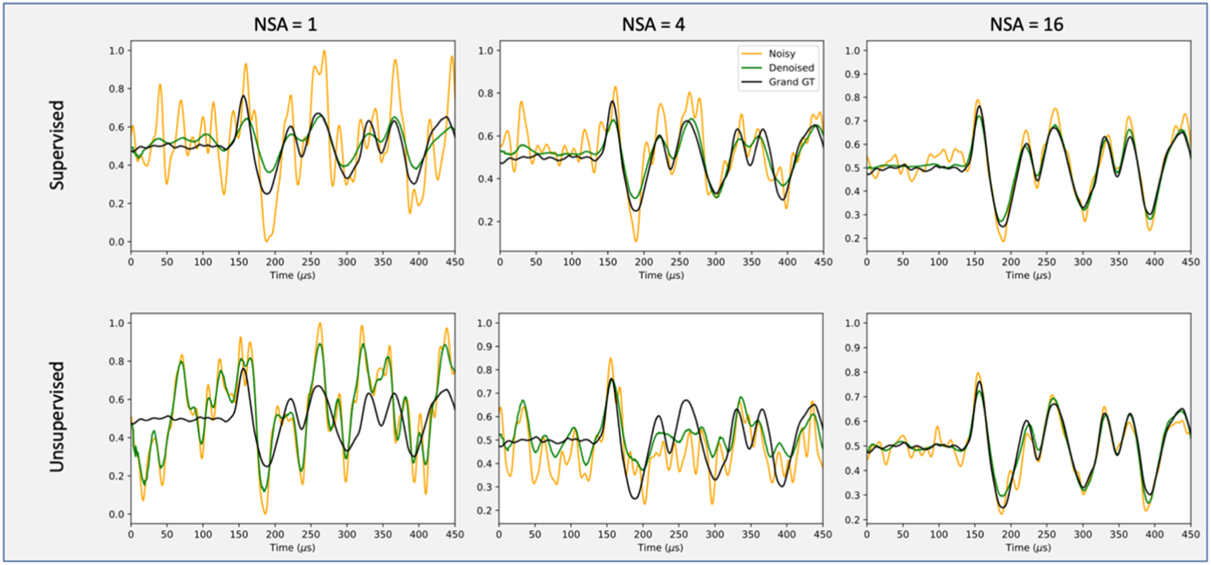Deep learning-based protoacoustic signal denoising for proton range ...