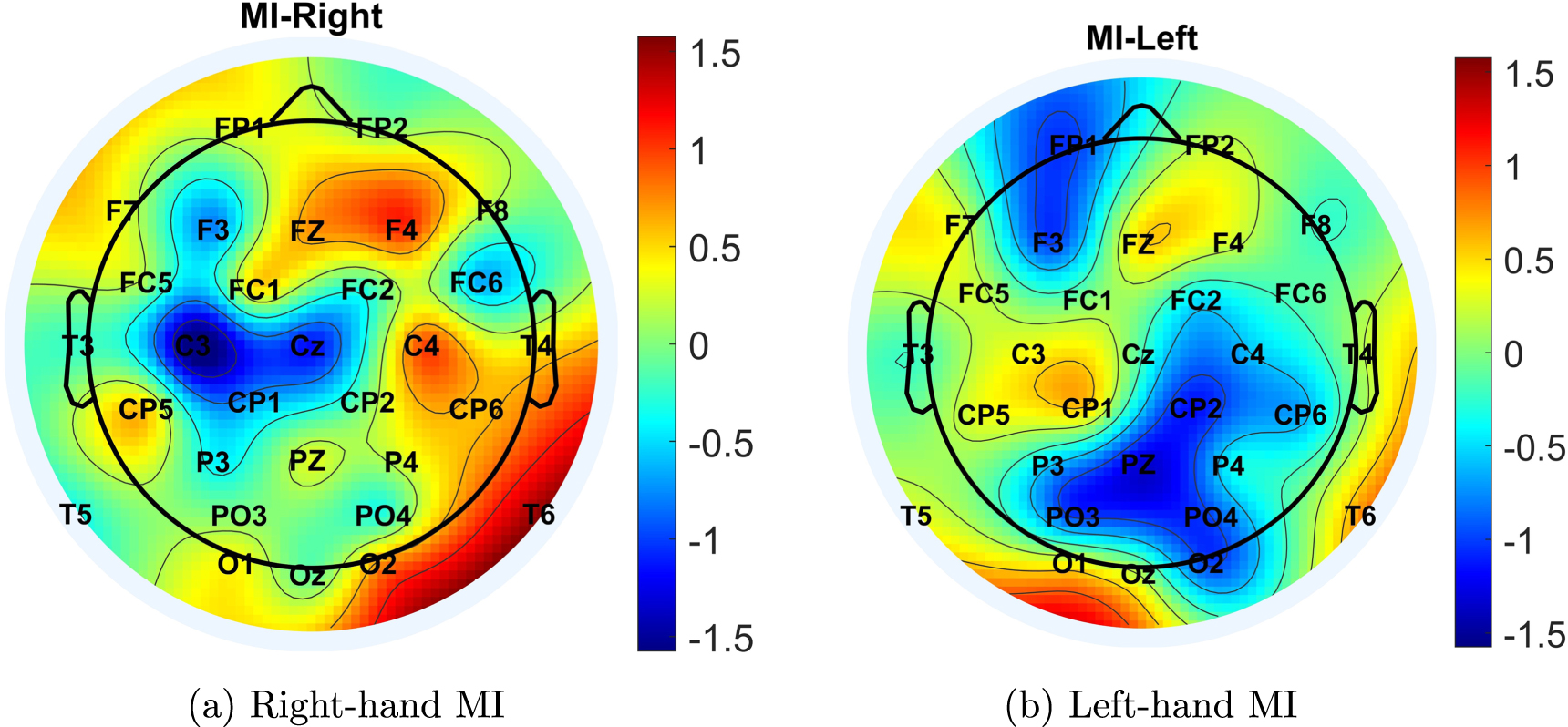 EEG motor imagery classification using deep learning approaches in ...
