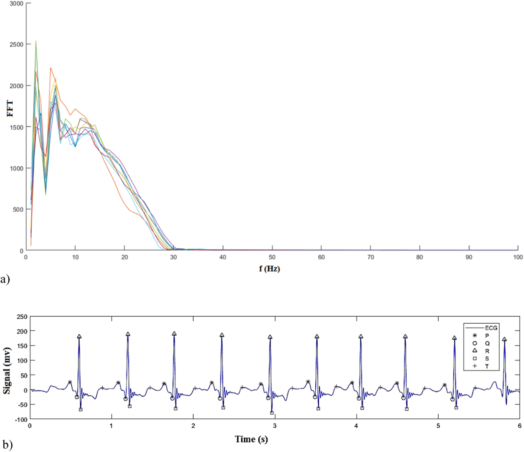 Classification of electrocardiogram signals using deep learning based ...