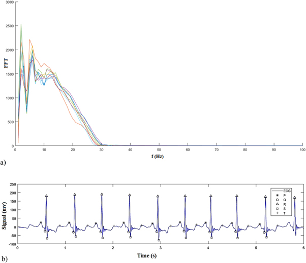 Classification of electrocardiogram signals using deep learning based ...