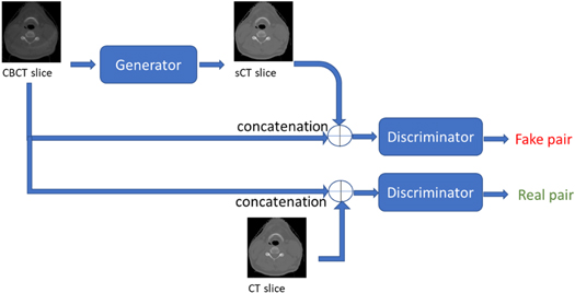 Generation of synthetic CT from CBCT using deep learning approaches for ...