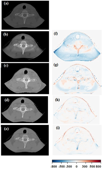 Generation of synthetic CT from CBCT using deep learning approaches for ...