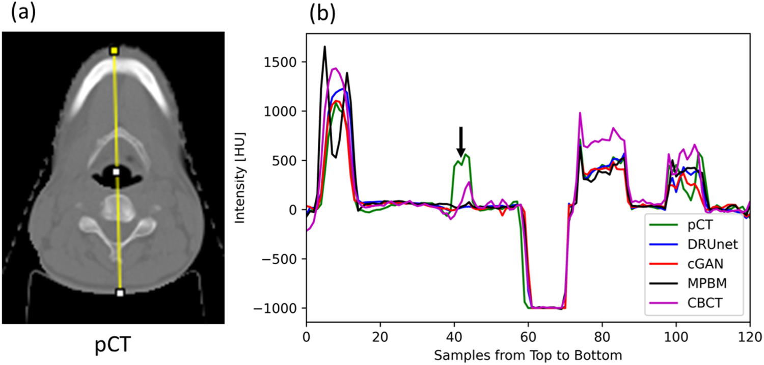 Generation of synthetic CT from CBCT using deep learning approaches for ...