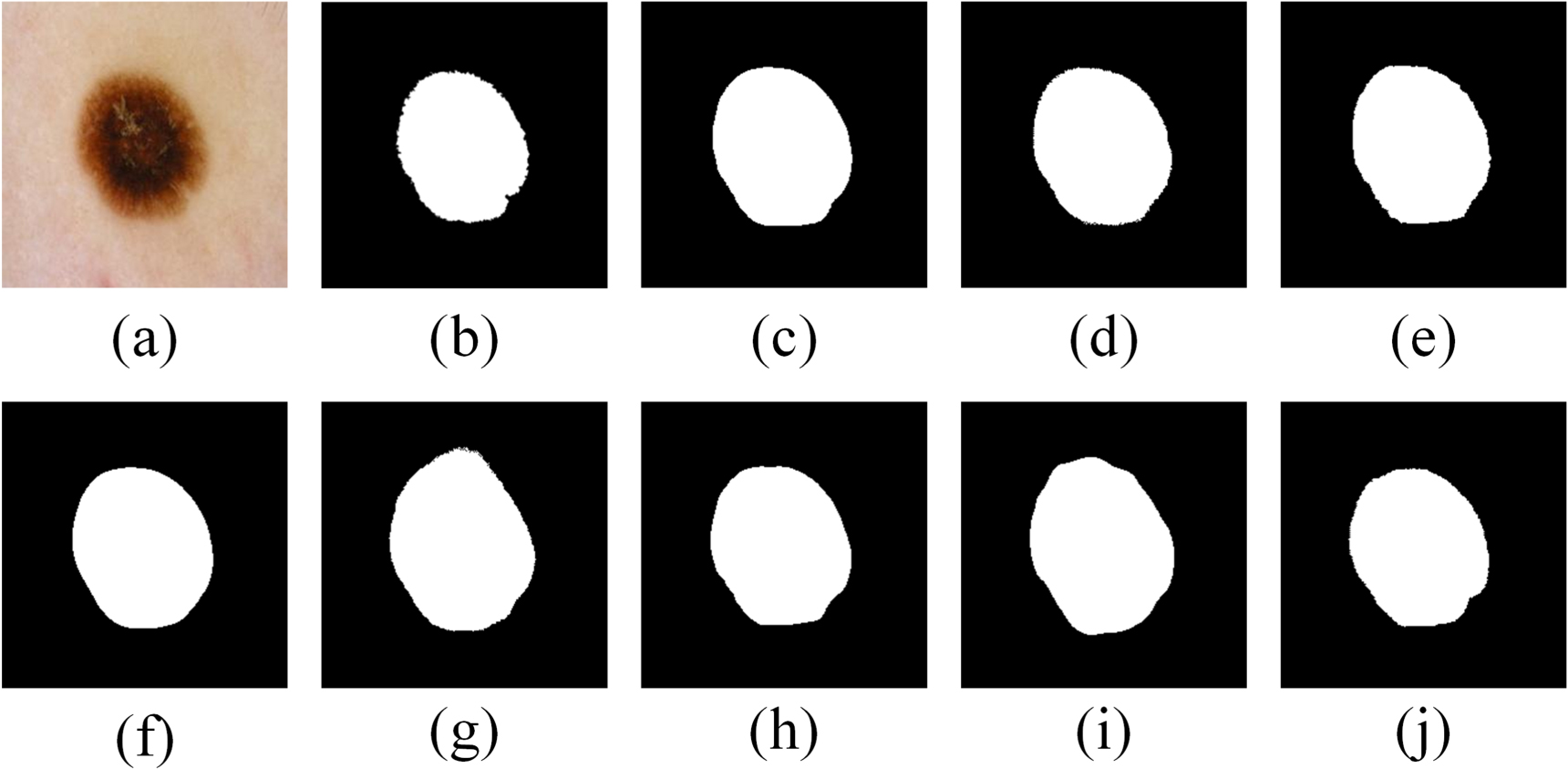 Skin lesion image segmentation based on lightweight multi-scale U ...