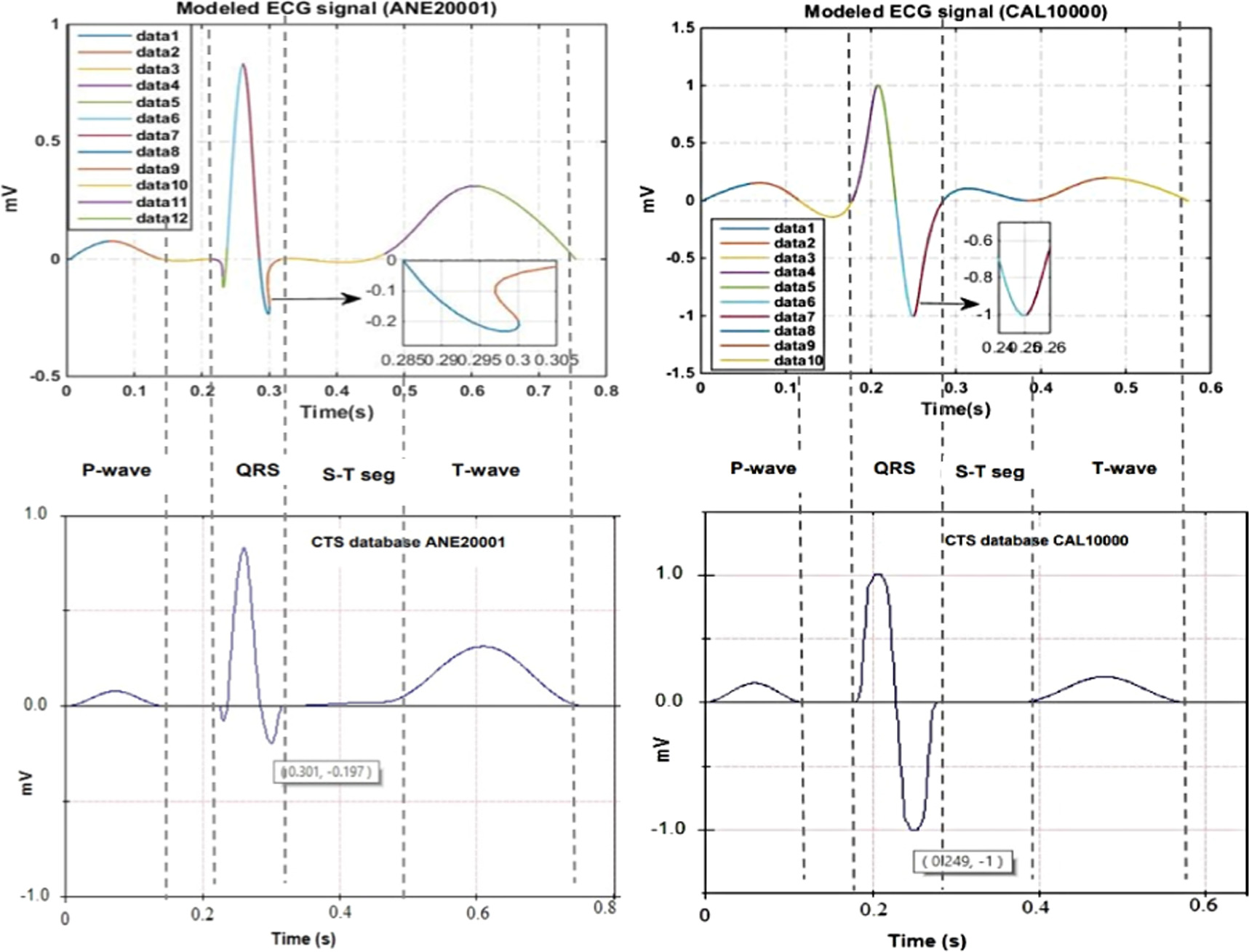 A piecewise spline approach for modeling of ECG signals - IOPscience