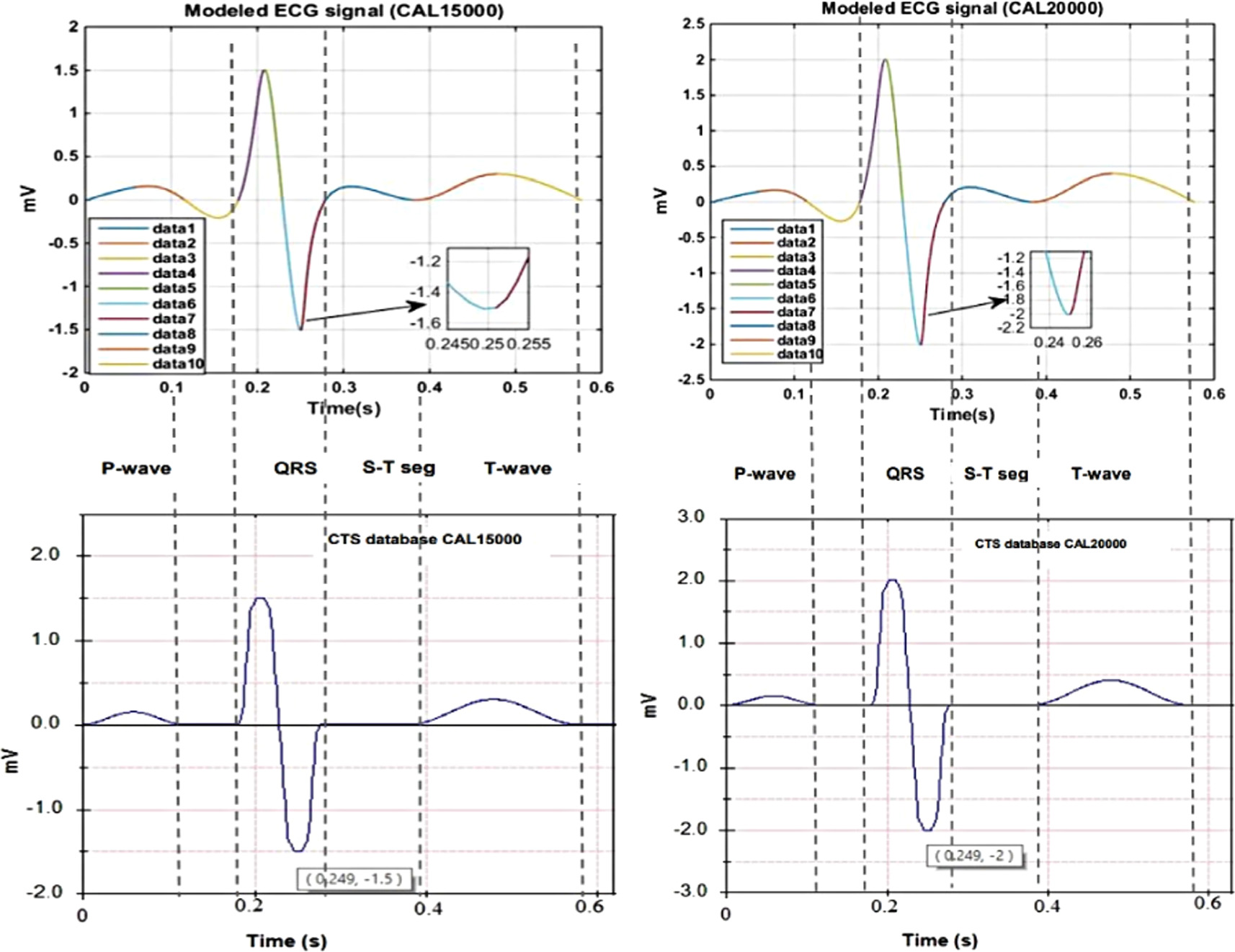 A piecewise spline approach for modeling of ECG signals - IOPscience