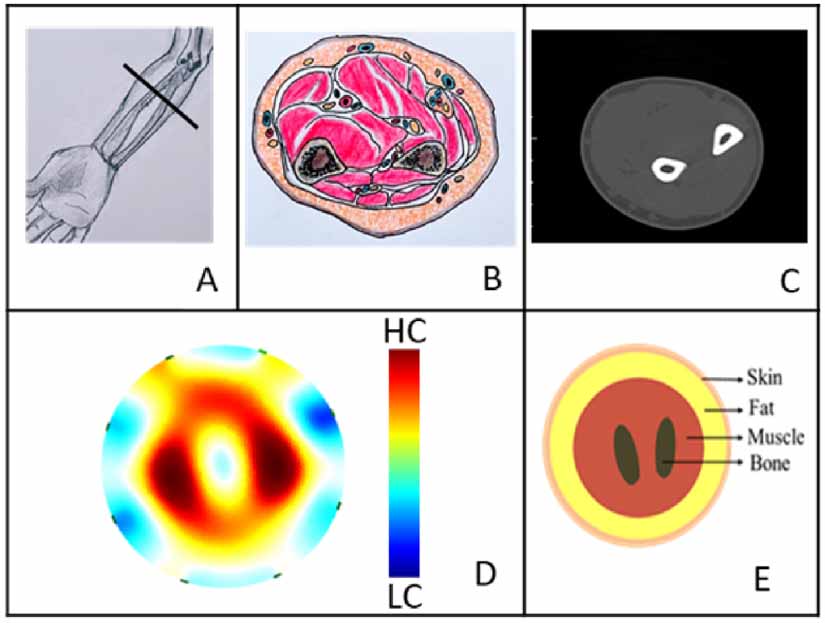 Fully printed, stretchable and wearable bioimpedance sensor on textiles ...