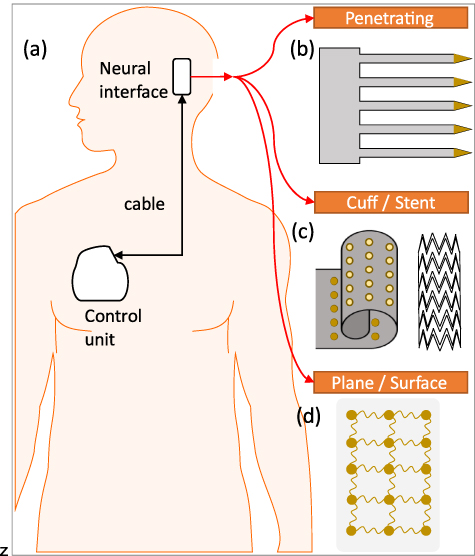 Interfixated Device Developing clinical grade flexible implantable electronics - IOPscience