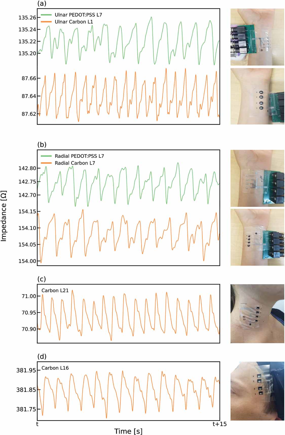 Printed soft skin electrodes for seamless bio-impedance measurements ...
