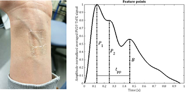 Additively fabricated on-skin sensors for mechanical and thermal ...
