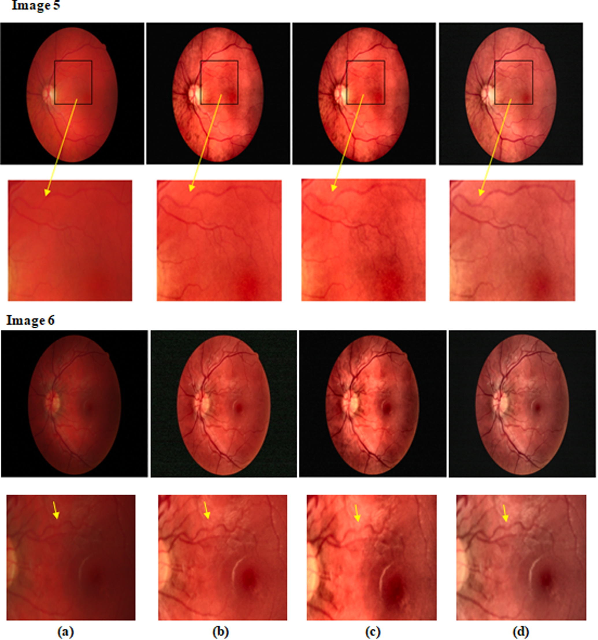 Contrast and Luminance Enhancement Technique for Fundus Images Using Bi ...