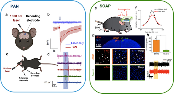 Cortex Pans Nanomaterial based photoacoustic interface for non-genetic ...