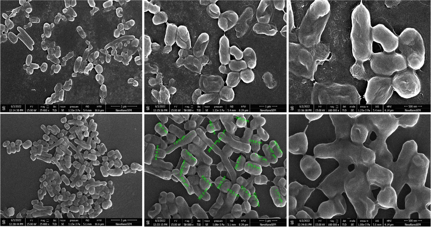 Isolation and characterization of arsenic resistant bacterial strian ...