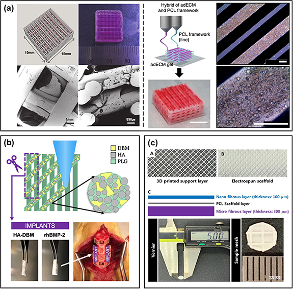 Biomaterials of human source for 3D printing strategies - IOPscience