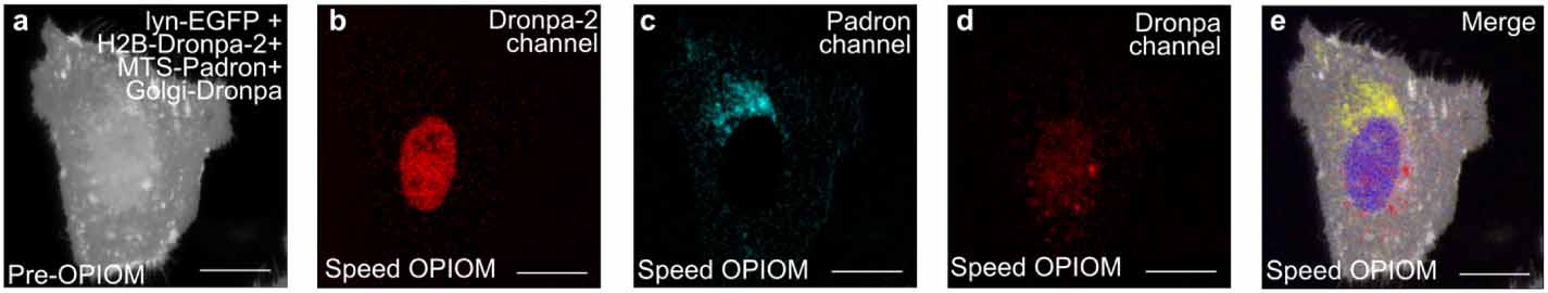 Dynamic contrast for overcoming spectral interferences in fluorescence ...