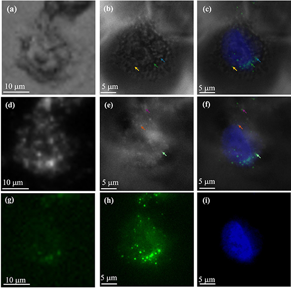 High-resolution multi-modal imaging of sub-cellular structures with low ...