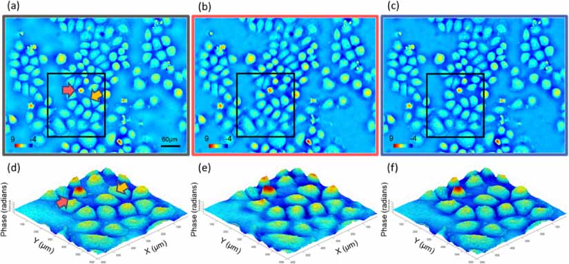 Quantitative differential phase contrast imaging system using FPGA for ...