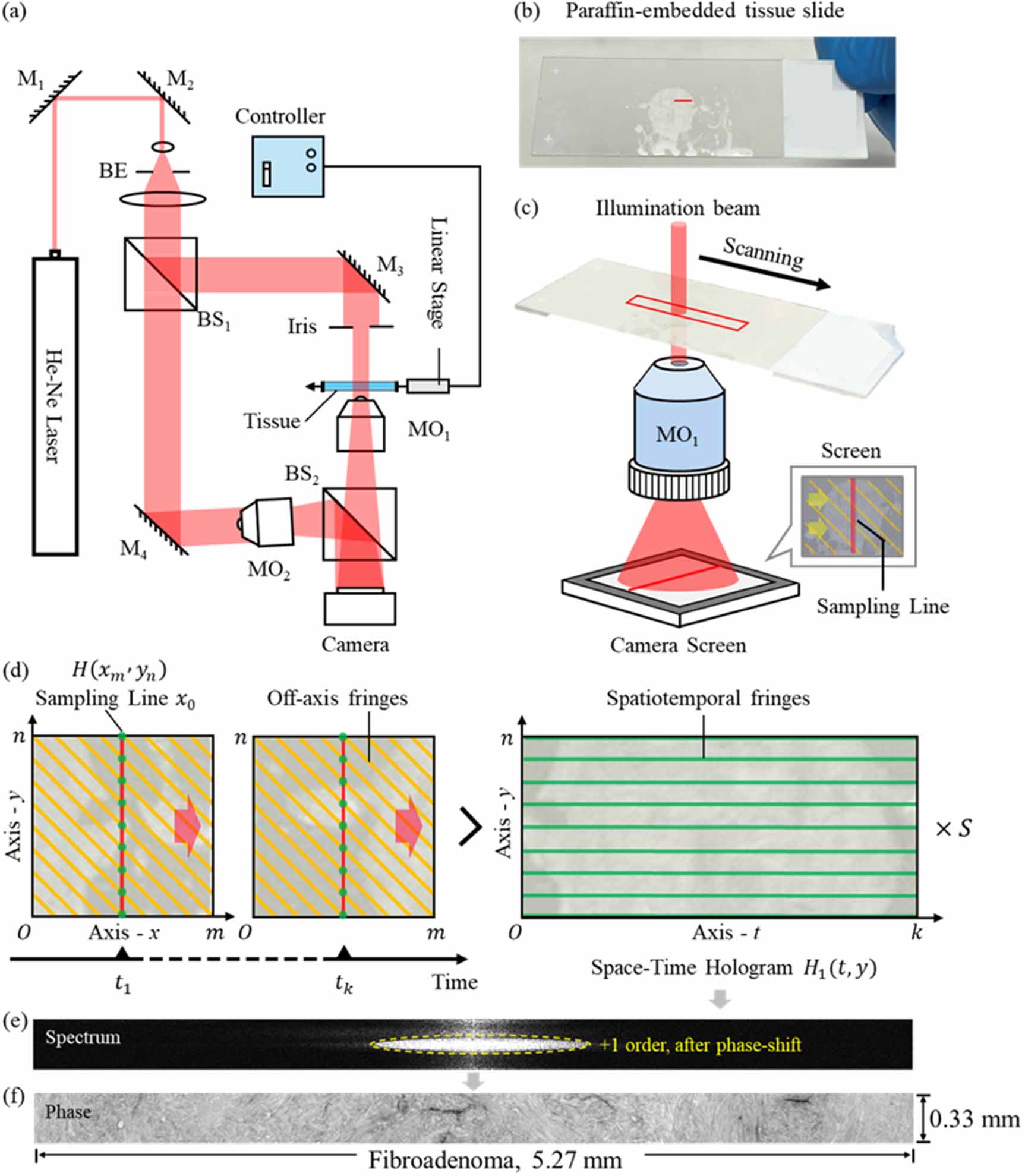 Whole slide phase imaging by space-time digital holography for stain ...