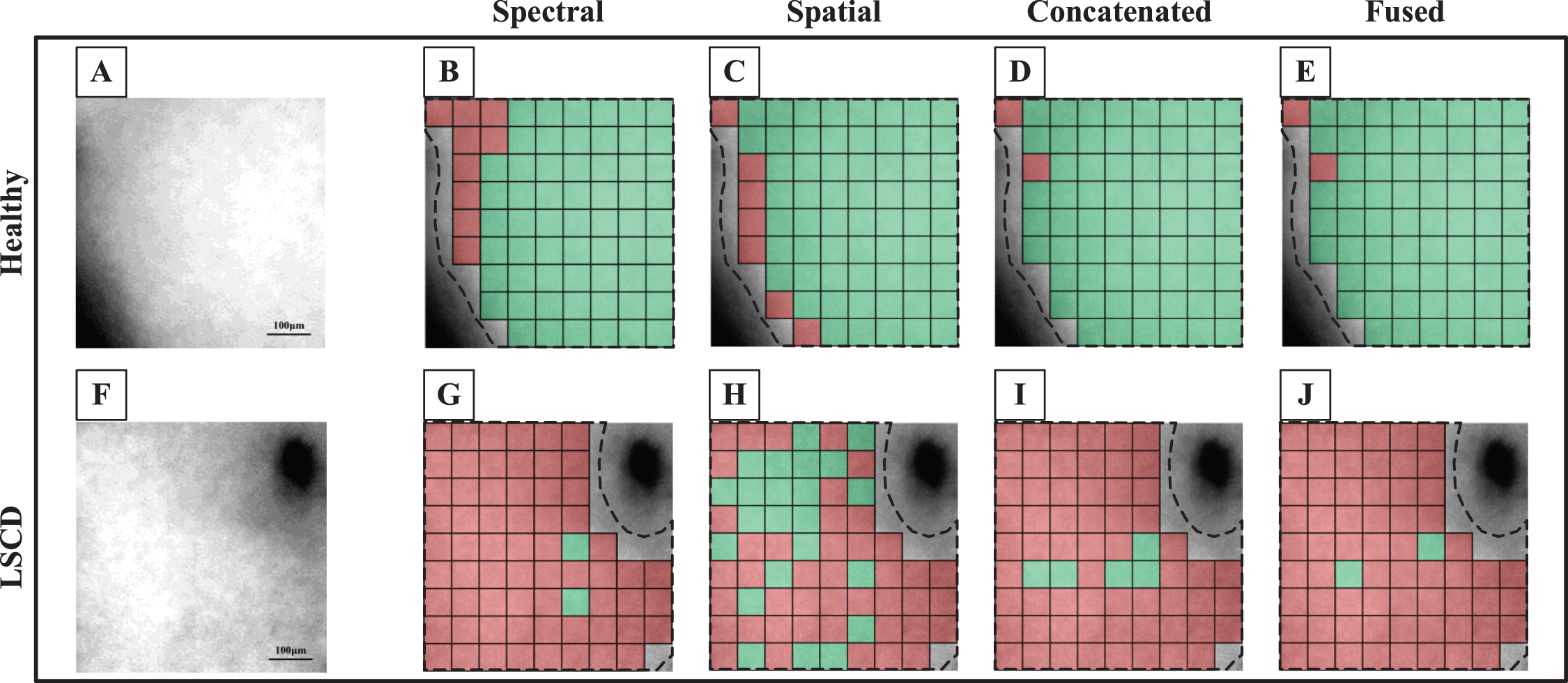 image feature and spectral feature fusion decoding. |... Contrastive learning-based spatial-spectral feature fusion for ...