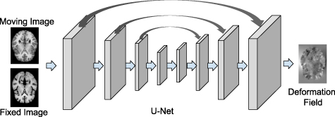 Deep learning in medical image registration - IOPscience