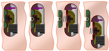 Ingestible devices for long-term gastrointestinal residency