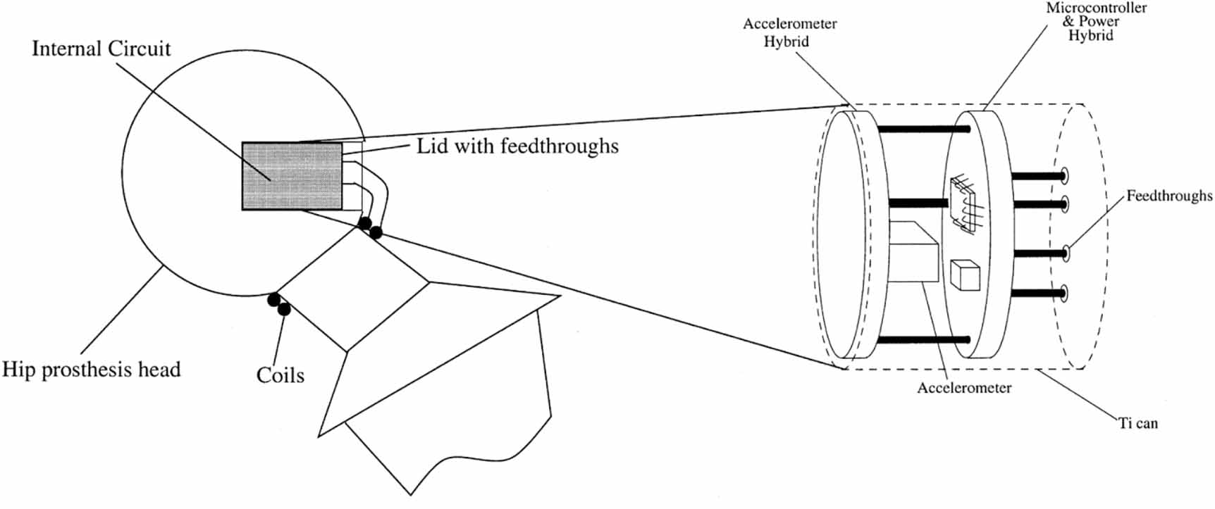 Is in vivo sensing in a total hip replacement a possibility? A review ...