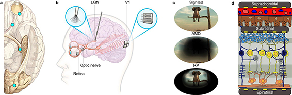 Advances in visual prostheses: engineering and biological challenges ...