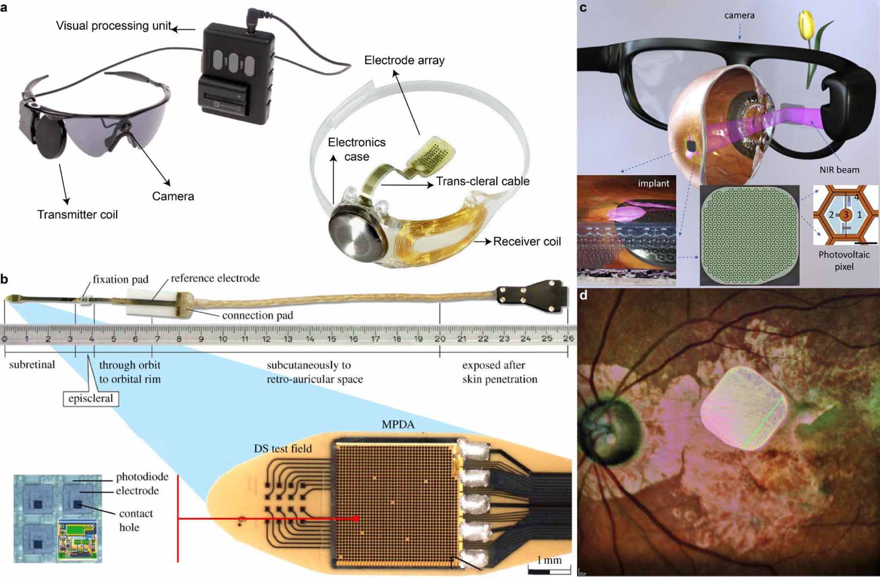 Advances in visual prostheses: engineering and biological challenges ...