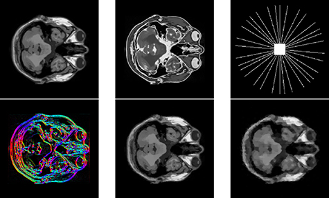 Mathematics of biomedical imaging today—a perspective - IOPscience