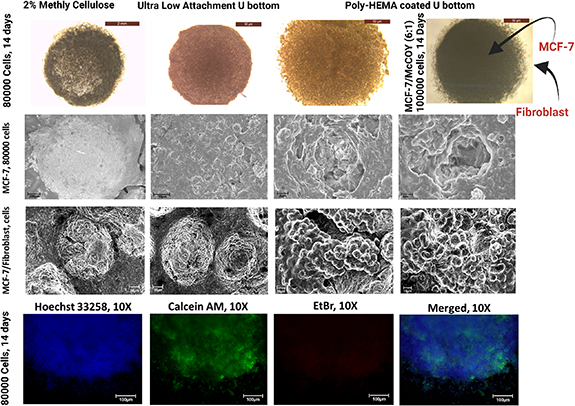 Development of bioengineered 3D patient derived breast cancer organoid ...