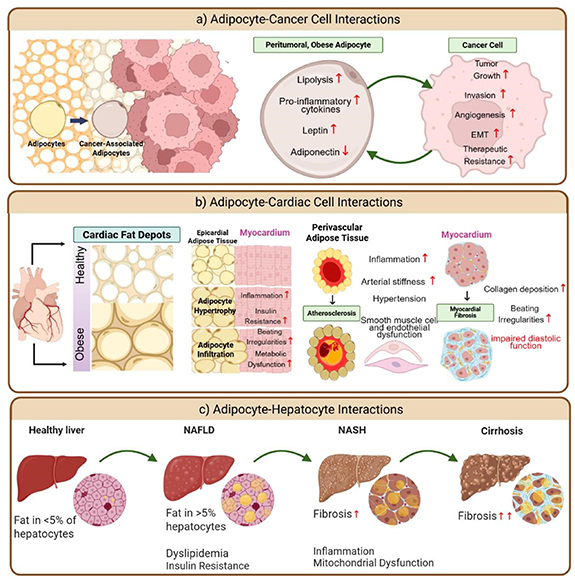 Tissue engineered models of adipose tissue dysfunction to investigate ...