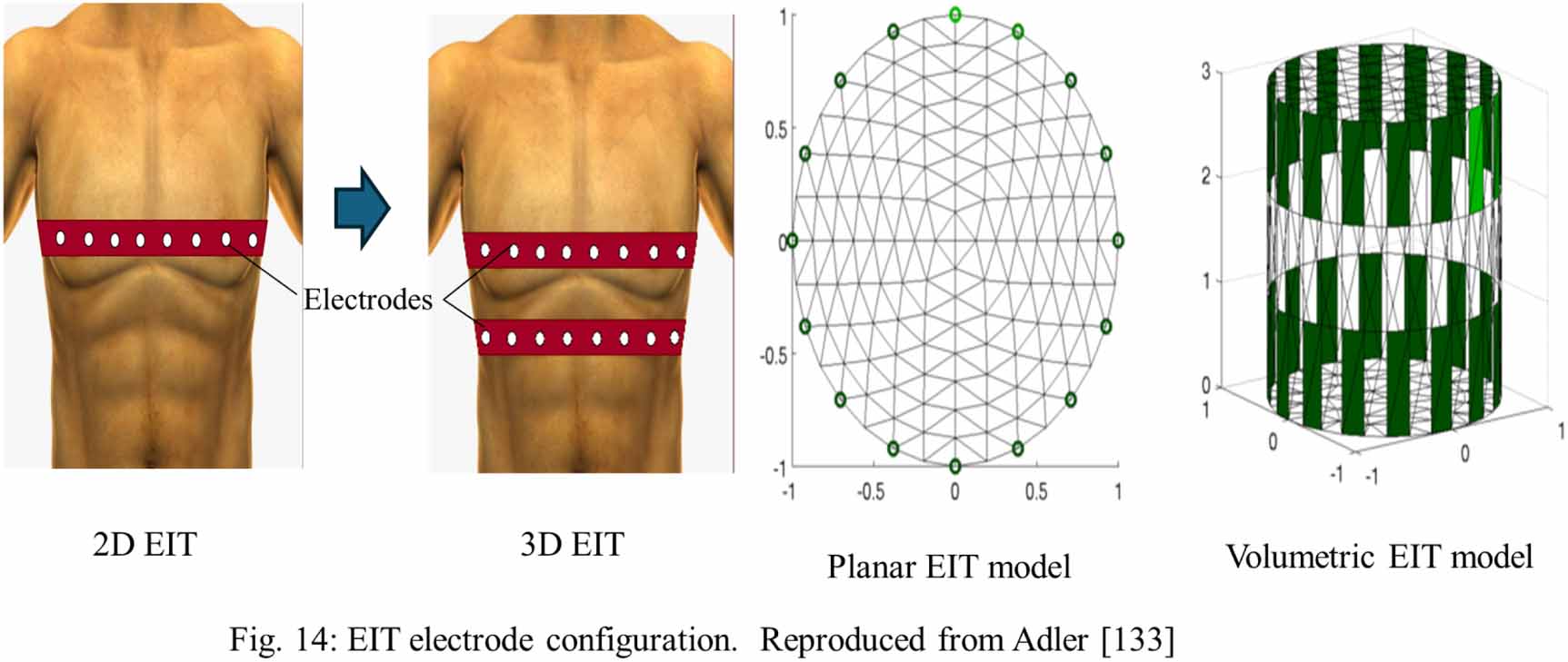 Advancing physical activity monitoring through bioimpedance measurement ...