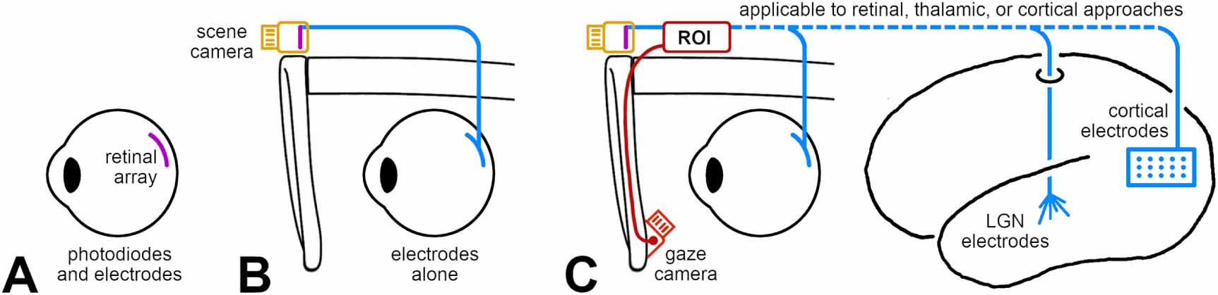 Motion perception with visual prostheses - IOPscience