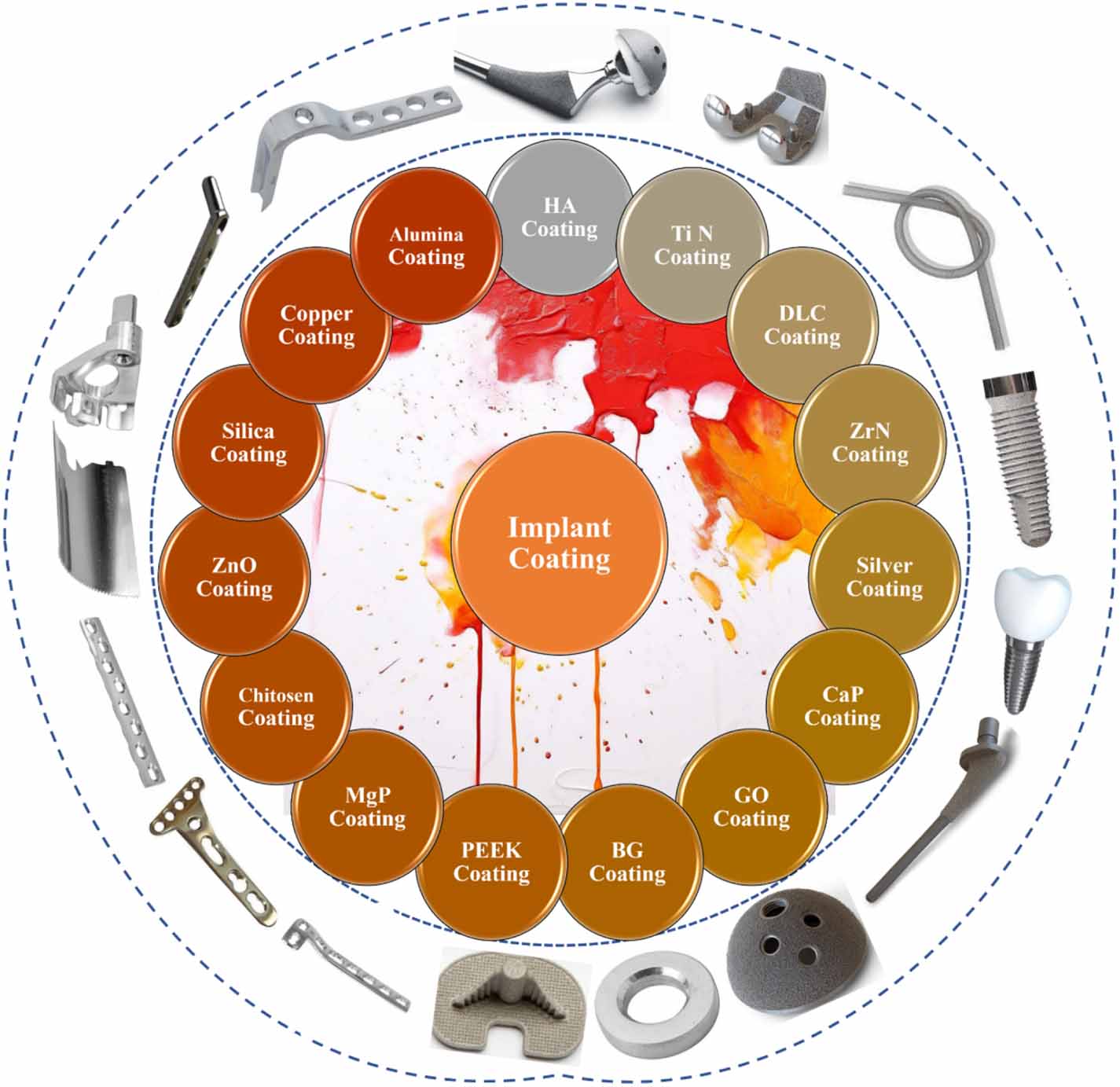 Engineered surfaces for biomedical implants: advances in coatings, materials, and techniques