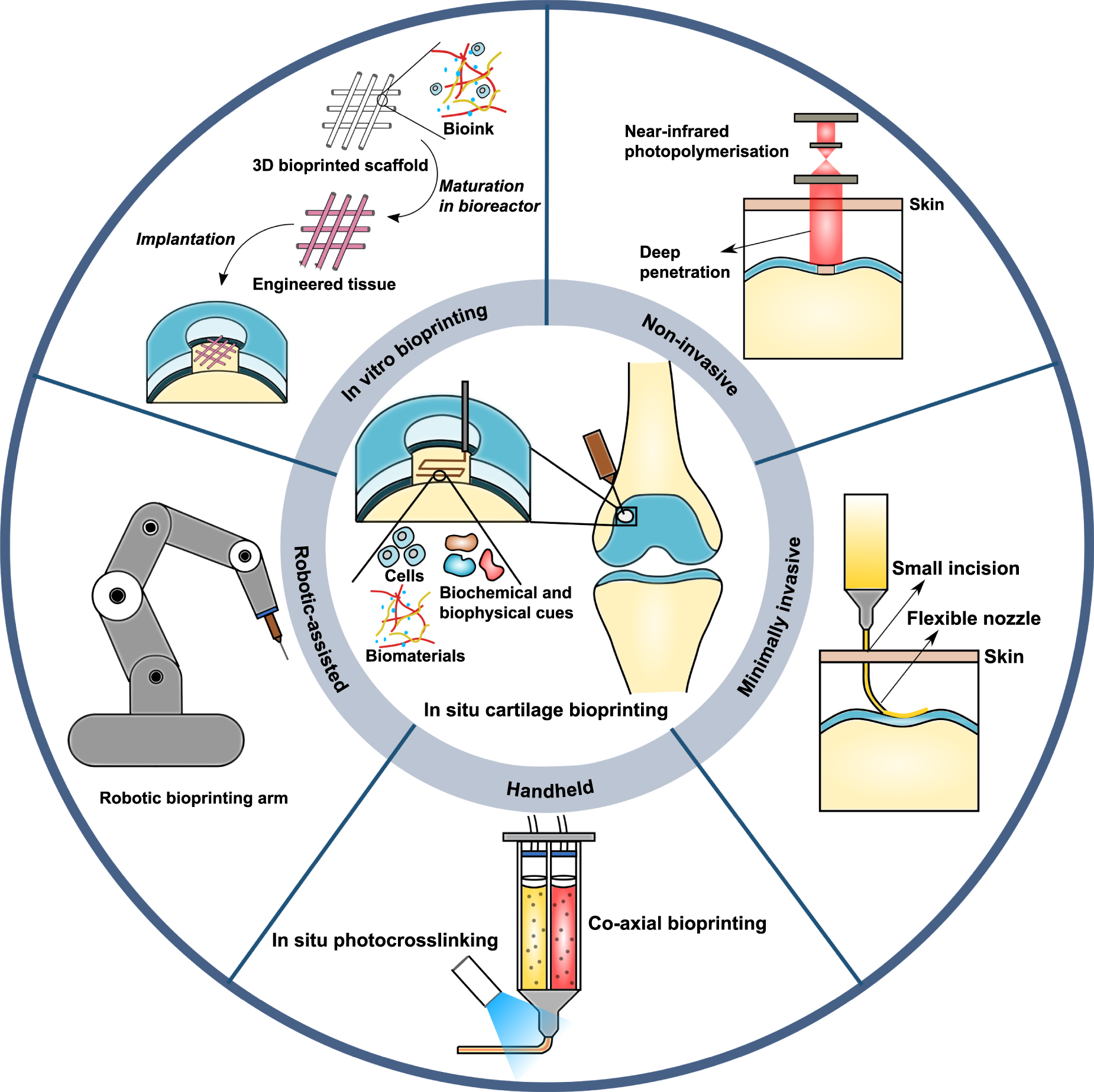 Robotic in situ bioprinting for cartilage tissue engineering - IOPscience
