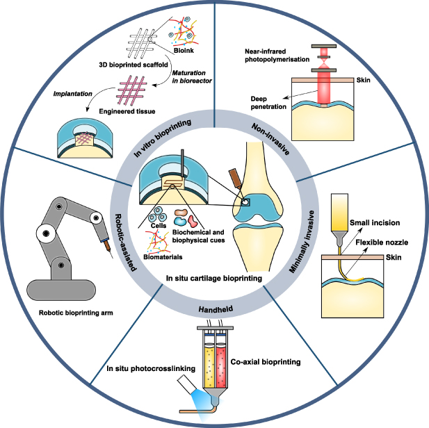 Robotic in situ bioprinting for cartilage tissue engineering - IOPscience
